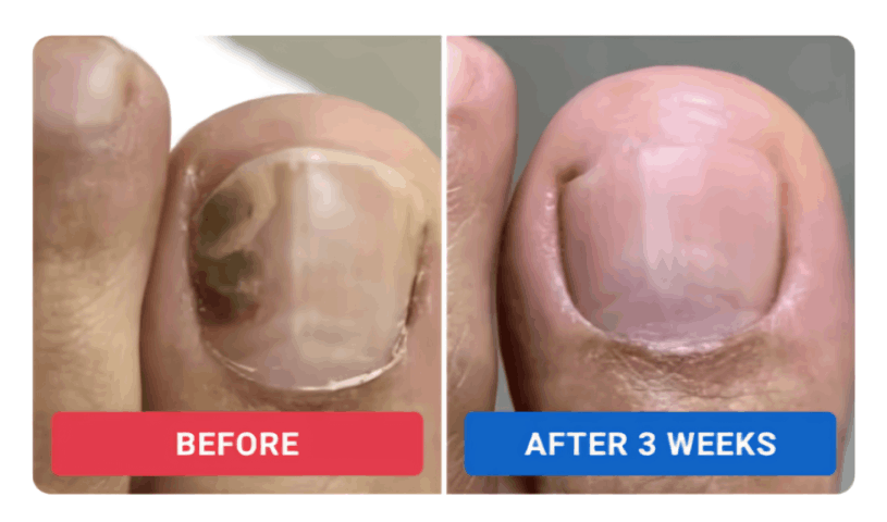 orivelle customer review Terry L.